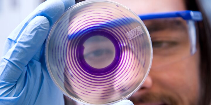 Student looking through a petri dish